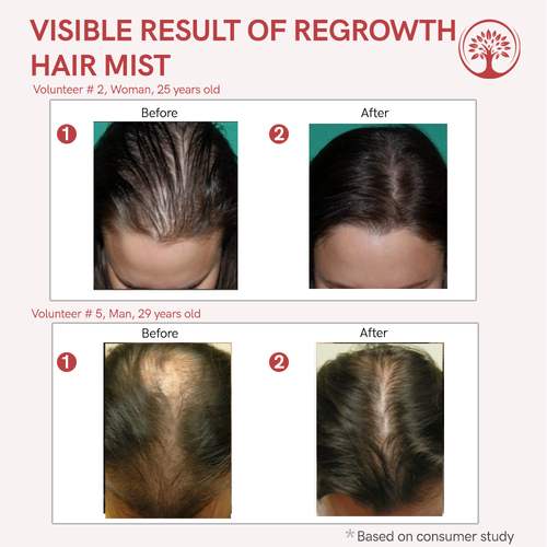 Ivory Natural Hair Mist For Long Hair For Growth Of Hair, Strengthen Follicles, And Restore Shine