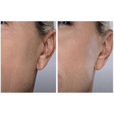 Spa Sciences SIMA Dermaplaning Replacement Safety Tips 6ct - New
