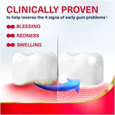 Parodontax Active Gum Repair Whitening Toothpaste 6.8oz/2pk - Imperfect Box