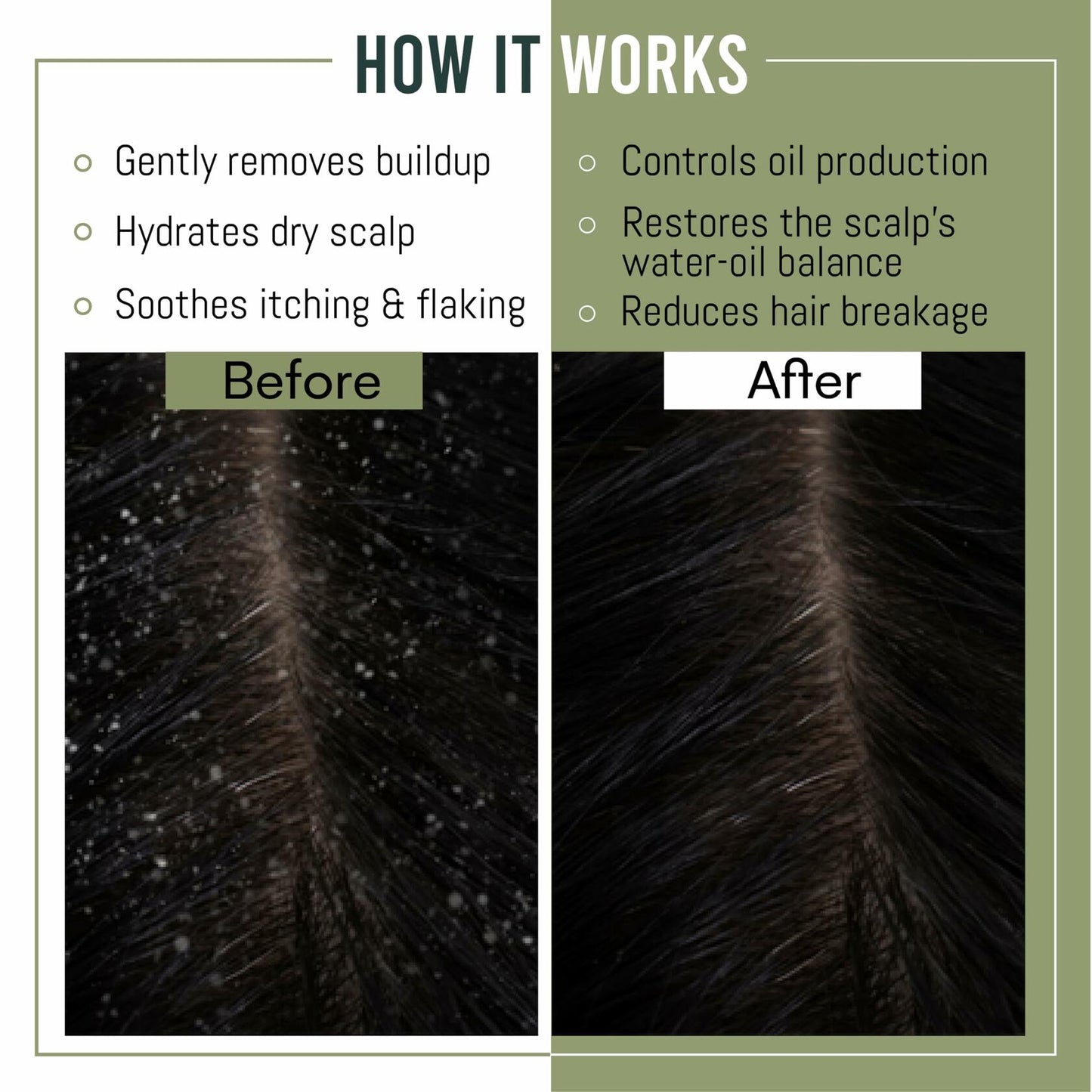 MagiForet Anti-Dandruff Shampoo & Conditioner Set 2x500ml Dry Flaky Scalp